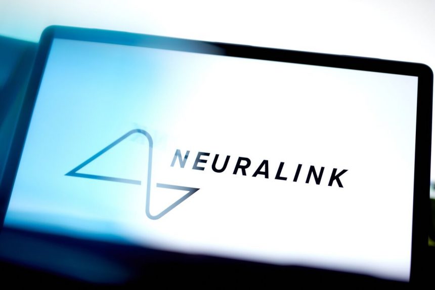 las-startups-cerebrales-de-china-se-enfrentan-a-neuralink-de-musk